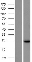 Western blot validation of overexpression lysate (Cat# LY431176) using anti-DDK antibody (Cat# TA50011-100). Left: Cell lysates from un-transfected HEK293T cells; Right: Cell lysates from HEK293T cells transfected with RC228148 using transfection reagent MegaTran 2.0 (Cat# TT210002).
