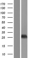 Western blot validation of overexpression lysate (Cat# LY431127) using anti-DDK antibody (Cat# TA50011-100). Left: Cell lysates from un-transfected HEK293T cells; Right: Cell lysates from HEK293T cells transfected with RC228099 using transfection reagent MegaTran 2.0 (Cat# TT210002).