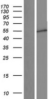 Western blot validation of overexpression lysate (Cat# LY431386) using anti-DDK antibody (Cat# TA50011-100). Left: Cell lysates from un-transfected HEK293T cells; Right: Cell lysates from HEK293T cells transfected with RC228358 using transfection reagent MegaTran 2.0 (Cat# TT210002).