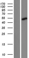 Western blot validation of overexpression lysate (Cat# LY431379) using anti-DDK antibody (Cat# TA50011-100). Left: Cell lysates from un-transfected HEK293T cells; Right: Cell lysates from HEK293T cells transfected with RC228351 using transfection reagent MegaTran 2.0 (Cat# TT210002).