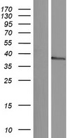 Western blot validation of overexpression lysate (Cat# LY431272) using anti-DDK antibody (Cat# TA50011-100). Left: Cell lysates from un-transfected HEK293T cells; Right: Cell lysates from HEK293T cells transfected with RC228244 using transfection reagent MegaTran 2.0 (Cat# TT210002).