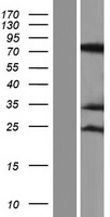 Western blot validation of overexpression lysate (Cat# LY408791) using anti-DDK antibody (Cat# TA50011-100). Left: Cell lysates from un-transfected HEK293T cells; Right: Cell lysates from HEK293T cells transfected with RC222034 using transfection reagent MegaTran 2.0 (Cat# TT210002).
