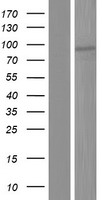 Western blot validation of overexpression lysate (Cat# LY414686) using anti-DDK antibody (Cat# TA50011-100). Left: Cell lysates from un-transfected HEK293T cells; Right: Cell lysates from HEK293T cells transfected with RC222147 using transfection reagent MegaTran 2.0 (Cat# TT210002).