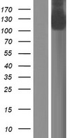 Western blot validation of overexpression lysate (Cat# LY424010) using anti-DDK antibody (Cat# TA50011-100). Left: Cell lysates from un-transfected HEK293T cells; Right: Cell lysates from HEK293T cells transfected with RC221993 using transfection reagent MegaTran 2.0 (Cat# TT210002).