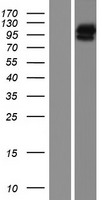 Western blot validation of overexpression lysate (Cat# LY421039) using anti-DDK antibody (Cat# TA50011-100). Left: Cell lysates from un-transfected HEK293T cells; Right: Cell lysates from HEK293T cells transfected with RC221579 using transfection reagent MegaTran 2.0 (Cat# TT210002).