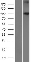 Western blot validation of overexpression lysate (Cat# LY421627) using anti-DDK antibody (Cat# TA50011-100). Left: Cell lysates from un-transfected HEK293T cells; Right: Cell lysates from HEK293T cells transfected with RC222120 using transfection reagent MegaTran 2.0 (Cat# TT210002).