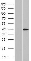 Western blot validation of overexpression lysate (Cat# LY405598) using anti-DDK antibody (Cat# TA50011-100). Left: Cell lysates from un-transfected HEK293T cells; Right: Cell lysates from HEK293T cells transfected with RC221749 using transfection reagent MegaTran 2.0 (Cat# TT210002).