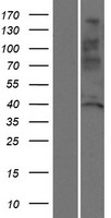 Western blot validation of overexpression lysate (Cat# LY414283) using anti-DDK antibody (Cat# TA50011-100). Left: Cell lysates from un-transfected HEK293T cells; Right: Cell lysates from HEK293T cells transfected with RC221805 using transfection reagent MegaTran 2.0 (Cat# TT210002).