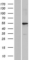 Western blot validation of overexpression lysate (Cat# LY403734) using anti-DDK antibody (Cat# TA50011-100). Left: Cell lysates from un-transfected HEK293T cells; Right: Cell lysates from HEK293T cells transfected with RC222547 using transfection reagent MegaTran 2.0 (Cat# TT210002).