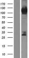 Western blot validation of overexpression lysate (Cat# LY413347) using anti-DDK antibody (Cat# TA50011-100). Left: Cell lysates from un-transfected HEK293T cells; Right: Cell lysates from HEK293T cells transfected with RC222590 using transfection reagent MegaTran 2.0 (Cat# TT210002).