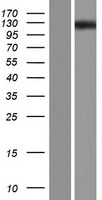 Western blot validation of overexpression lysate (Cat# LY405258) using anti-DDK antibody (Cat# TA50011-100). Left: Cell lysates from un-transfected HEK293T cells; Right: Cell lysates from HEK293T cells transfected with RC222589 using transfection reagent MegaTran 2.0 (Cat# TT210002).