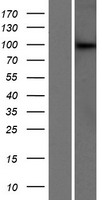 Western blot validation of overexpression lysate (Cat# LY413024) using anti-DDK antibody (Cat# TA50011-100). Left: Cell lysates from un-transfected HEK293T cells; Right: Cell lysates from HEK293T cells transfected with RC222570 using transfection reagent MegaTran 2.0 (Cat# TT210002).