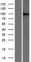 Western blot validation of overexpression lysate (Cat# LY413024) using anti-DDK antibody (Cat# TA50011-100). Left: Cell lysates from un-transfected HEK293T cells; Right: Cell lysates from HEK293T cells transfected with RC222570 using transfection reagent MegaTran 2.0 (Cat# TT210002).