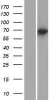 Western blot validation of overexpression lysate (Cat# LY407525) using anti-DDK antibody (Cat# TA50011-100). Left: Cell lysates from un-transfected HEK293T cells; Right: Cell lysates from HEK293T cells transfected with RC222526 using transfection reagent MegaTran 2.0 (Cat# TT210002).