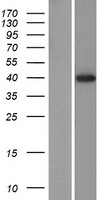 Western blot validation of overexpression lysate (Cat# LY422996) using anti-DDK antibody (Cat# TA50011-100). Left: Cell lysates from un-transfected HEK293T cells; Right: Cell lysates from HEK293T cells transfected with RC222479 using transfection reagent MegaTran 2.0 (Cat# TT210002).
