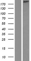Western blot validation of overexpression lysate (Cat# LY411787) using anti-DDK antibody (Cat# TA50011-100). Left: Cell lysates from un-transfected HEK293T cells; Right: Cell lysates from HEK293T cells transfected with RC222567 using transfection reagent MegaTran 2.0 (Cat# TT210002).
