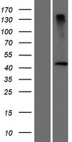 Western blot validation of overexpression lysate (Cat# LY407549) using anti-DDK antibody (Cat# TA50011-100). Left: Cell lysates from un-transfected HEK293T cells; Right: Cell lysates from HEK293T cells transfected with RC222673 using transfection reagent MegaTran 2.0 (Cat# TT210002).