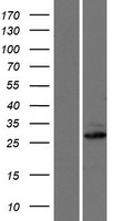 Western blot validation of overexpression lysate (Cat# LY423212) using anti-DDK antibody (Cat# TA50011-100). Left: Cell lysates from un-transfected HEK293T cells; Right: Cell lysates from HEK293T cells transfected with RC222231 using transfection reagent MegaTran 2.0 (Cat# TT210002).