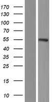 Western blot validation of overexpression lysate (Cat# LY415832) using anti-DDK antibody (Cat# TA50011-100). Left: Cell lysates from un-transfected HEK293T cells; Right: Cell lysates from HEK293T cells transfected with RC222223 using transfection reagent MegaTran 2.0 (Cat# TT210002).