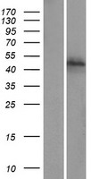 Western blot validation of overexpression lysate (Cat# LY406930) using anti-DDK antibody (Cat# TA50011-100). Left: Cell lysates from un-transfected HEK293T cells; Right: Cell lysates from HEK293T cells transfected with RC222218 using transfection reagent MegaTran 2.0 (Cat# TT210002).