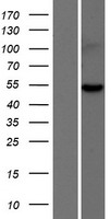 Western blot validation of overexpression lysate (Cat# LY423988) using anti-DDK antibody (Cat# TA50011-100). Left: Cell lysates from un-transfected HEK293T cells; Right: Cell lysates from HEK293T cells transfected with RC222188 using transfection reagent MegaTran 2.0 (Cat# TT210002).