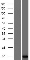 Western blot validation of overexpression lysate (Cat# LY405955) using anti-DDK antibody (Cat# TA50011-100). Left: Cell lysates from un-transfected HEK293T cells; Right: Cell lysates from HEK293T cells transfected with RC222176 using transfection reagent MegaTran 2.0 (Cat# TT210002).