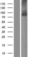 Western blot validation of overexpression lysate (Cat# LY421474) using anti-DDK antibody (Cat# TA50011-100). Left: Cell lysates from un-transfected HEK293T cells; Right: Cell lysates from HEK293T cells transfected with RC222390 using transfection reagent MegaTran 2.0 (Cat# TT210002).