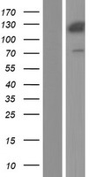 Western blot validation of overexpression lysate (Cat# LY414713) using anti-DDK antibody (Cat# TA50011-100). Left: Cell lysates from un-transfected HEK293T cells; Right: Cell lysates from HEK293T cells transfected with RC222439 using transfection reagent MegaTran 2.0 (Cat# TT210002).