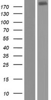 Western blot validation of overexpression lysate (Cat# LY408015) using anti-DDK antibody (Cat# TA50011-100). Left: Cell lysates from un-transfected HEK293T cells; Right: Cell lysates from HEK293T cells transfected with RC222427 using transfection reagent MegaTran 2.0 (Cat# TT210002).