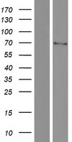 Western blot validation of overexpression lysate (Cat# LY406370) using anti-DDK antibody (Cat# TA50011-100). Left: Cell lysates from un-transfected HEK293T cells; Right: Cell lysates from HEK293T cells transfected with RC222353 using transfection reagent MegaTran 2.0 (Cat# TT210002).