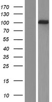 Western blot validation of overexpression lysate (Cat# LY420857) using anti-DDK antibody (Cat# TA50011-100). Left: Cell lysates from un-transfected HEK293T cells; Right: Cell lysates from HEK293T cells transfected with RC222398 using transfection reagent MegaTran 2.0 (Cat# TT210002).