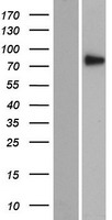 Western blot validation of overexpression lysate (Cat# LY415109) using anti-DDK antibody (Cat# TA50011-100). Left: Cell lysates from un-transfected HEK293T cells; Right: Cell lysates from HEK293T cells transfected with RC220818 using transfection reagent MegaTran 2.0 (Cat# TT210002).