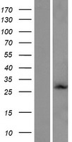 Western blot validation of overexpression lysate (Cat# LY421467) using anti-DDK antibody (Cat# TA50011-100). Left: Cell lysates from un-transfected HEK293T cells; Right: Cell lysates from HEK293T cells transfected with RC220917 using transfection reagent MegaTran 2.0 (Cat# TT210002).