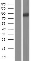 Western blot validation of overexpression lysate (Cat# LY416272) using anti-DDK antibody (Cat# TA50011-100). Left: Cell lysates from un-transfected HEK293T cells; Right: Cell lysates from HEK293T cells transfected with RC220913 using transfection reagent MegaTran 2.0 (Cat# TT210002).