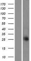 Western blot validation of overexpression lysate (Cat# LY422061) using anti-DDK antibody (Cat# TA50011-100). Left: Cell lysates from un-transfected HEK293T cells; Right: Cell lysates from HEK293T cells transfected with RC220639 using transfection reagent MegaTran 2.0 (Cat# TT210002).