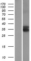 Western blot validation of overexpression lysate (Cat# LY410610) using anti-DDK antibody (Cat# TA50011-100). Left: Cell lysates from un-transfected HEK293T cells; Right: Cell lysates from HEK293T cells transfected with RC220609 using transfection reagent MegaTran 2.0 (Cat# TT210002).