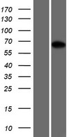 Western blot validation of overexpression lysate (Cat# LY421625) using anti-DDK antibody (Cat# TA50011-100). Left: Cell lysates from un-transfected HEK293T cells; Right: Cell lysates from HEK293T cells transfected with RC221365 using transfection reagent MegaTran 2.0 (Cat# TT210002).