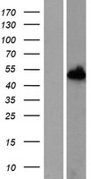 Western blot validation of overexpression lysate (Cat# LY411678) using anti-DDK antibody (Cat# TA50011-100). Left: Cell lysates from un-transfected HEK293T cells; Right: Cell lysates from HEK293T cells transfected with RC221343 using transfection reagent MegaTran 2.0 (Cat# TT210002).