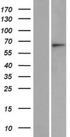 Western blot validation of overexpression lysate (Cat# LY408973) using anti-DDK antibody (Cat# TA50011-100). Left: Cell lysates from un-transfected HEK293T cells; Right: Cell lysates from HEK293T cells transfected with RC221547 using transfection reagent MegaTran 2.0 (Cat# TT210002).
