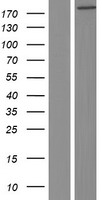 Western blot validation of overexpression lysate (Cat# LY423986) using anti-DDK antibody (Cat# TA50011-100). Left: Cell lysates from un-transfected HEK293T cells; Right: Cell lysates from HEK293T cells transfected with RC221059 using transfection reagent MegaTran 2.0 (Cat# TT210002).