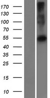 Western blot validation of overexpression lysate (Cat# LY420289) using anti-DDK antibody (Cat# TA50011-100). Left: Cell lysates from un-transfected HEK293T cells; Right: Cell lysates from HEK293T cells transfected with RC221030 using transfection reagent MegaTran 2.0 (Cat# TT210002).