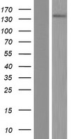 Western blot validation of overexpression lysate (Cat# LY410289) using anti-DDK antibody (Cat# TA50011-100). Left: Cell lysates from un-transfected HEK293T cells; Right: Cell lysates from HEK293T cells transfected with RC221270 using transfection reagent MegaTran 2.0 (Cat# TT210002).