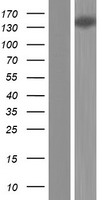 Western blot validation of overexpression lysate (Cat# LY422250) using anti-DDK antibody (Cat# TA50011-100). Left: Cell lysates from un-transfected HEK293T cells; Right: Cell lysates from HEK293T cells transfected with RC221201 using transfection reagent MegaTran 2.0 (Cat# TT210002).