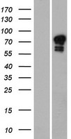 Western blot validation of overexpression lysate (Cat# LY422006) using anti-DDK antibody (Cat# TA50011-100). Left: Cell lysates from un-transfected HEK293T cells; Right: Cell lysates from HEK293T cells transfected with RC221196 using transfection reagent MegaTran 2.0 (Cat# TT210002).