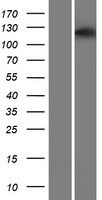 Western blot validation of overexpression lysate (Cat# LY414647) using anti-DDK antibody (Cat# TA50011-100). Left: Cell lysates from un-transfected HEK293T cells; Right: Cell lysates from HEK293T cells transfected with RC221172 using transfection reagent MegaTran 2.0 (Cat# TT210002).