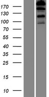 Western blot validation of overexpression lysate (Cat# LY410875) using anti-DDK antibody (Cat# TA50011-100). Left: Cell lysates from un-transfected HEK293T cells; Right: Cell lysates from HEK293T cells transfected with RC221215 using transfection reagent MegaTran 2.0 (Cat# TT210002).