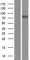 Western blot validation of overexpression lysate (Cat# LY404006) using anti-DDK antibody (Cat# TA50011-100). Left: Cell lysates from un-transfected HEK293T cells; Right: Cell lysates from HEK293T cells transfected with RC224029 using transfection reagent MegaTran 2.0 (Cat# TT210002).