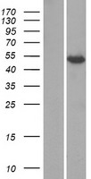 Western blot validation of overexpression lysate (Cat# LY405027) using anti-DDK antibody (Cat# TA50011-100). Left: Cell lysates from un-transfected HEK293T cells; Right: Cell lysates from HEK293T cells transfected with RC223904 using transfection reagent MegaTran 2.0 (Cat# TT210002).