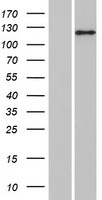 Western blot validation of overexpression lysate (Cat# LY412842) using anti-DDK antibody (Cat# TA50011-100). Left: Cell lysates from un-transfected HEK293T cells; Right: Cell lysates from HEK293T cells transfected with RC224186 using transfection reagent MegaTran 2.0 (Cat# TT210002).