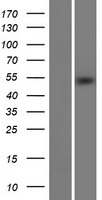 Western blot validation of overexpression lysate (Cat# LY422275) using anti-DDK antibody (Cat# TA50011-100). Left: Cell lysates from un-transfected HEK293T cells; Right: Cell lysates from HEK293T cells transfected with RC224065 using transfection reagent MegaTran 2.0 (Cat# TT210002).